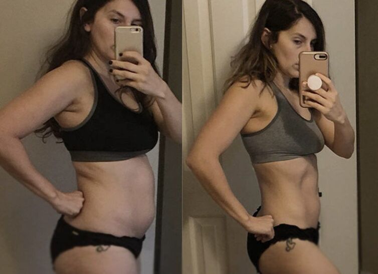 Chica antes y después de la dieta cetogénica